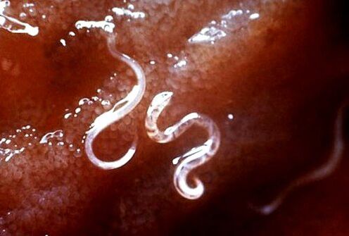 parasitoak gorputz barruan